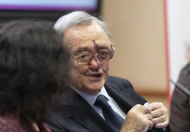 發起募款活動以支持西班牙在胰臟癌研究上的突破